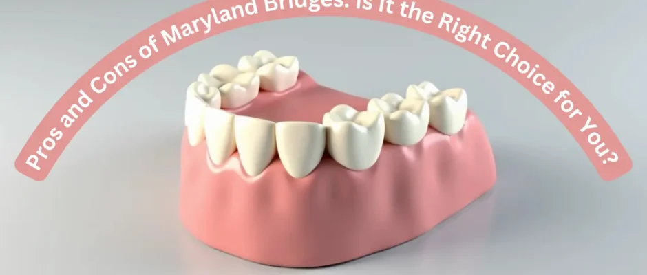 Pros and Cons of Maryland Bridges: Is It the Right Choice for You